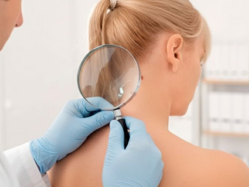 Procedimento de Dermatologia Clínica